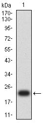 Western Blot: Gr-1/Ly-6G Antibody (3D6E10) [NBP3-27164] - Analysis using Gr-1/Ly-6G mAb against human Gr-1/Ly-6G (AA: 20-104) recombinant protein. (Expected MW is 21.4 kDa)