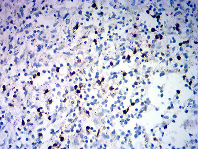 Immunohistochemistry TRBC1 Antibody (5A8A10)