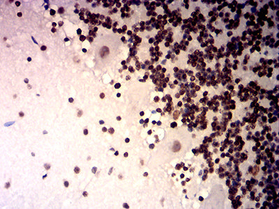 Immunohistochemistry: TRBC1 Antibody (5D9F1) [NBP3-27180] - Analysis of paraffin-embedded cerebellum tissues using TRBC1 mouse mAb with DAB staining.