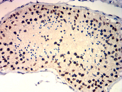 Immunohistochemistry: TRBC1 Antibody (5D9F1) [NBP3-27180] - Analysis of paraffin-embedded testis tissues using TRBC1 mouse mAb with DAB staining.