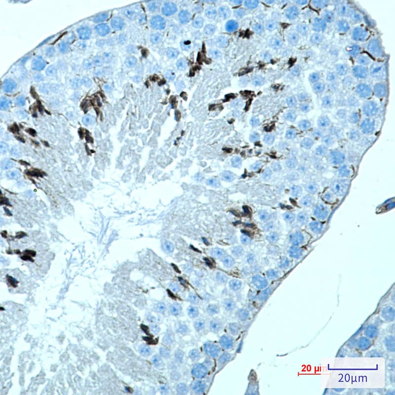 Immunohistochemistry-Paraffin: Melanoma antigen family C2 Antibody (SR2353) [NBP3-27683] - Immunohistochemistry analysis of paraffin-embedded mouse testis. High-pressure and temperature Sodium Citrate pH 6.0 was used for antigen retrieval.