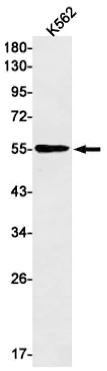 Western Blot: Melanoma antigen family C2 Antibody (SR2353) [NBP3-27683] - Western blot analysis of K562 lysates using MAGEE1 antibody.