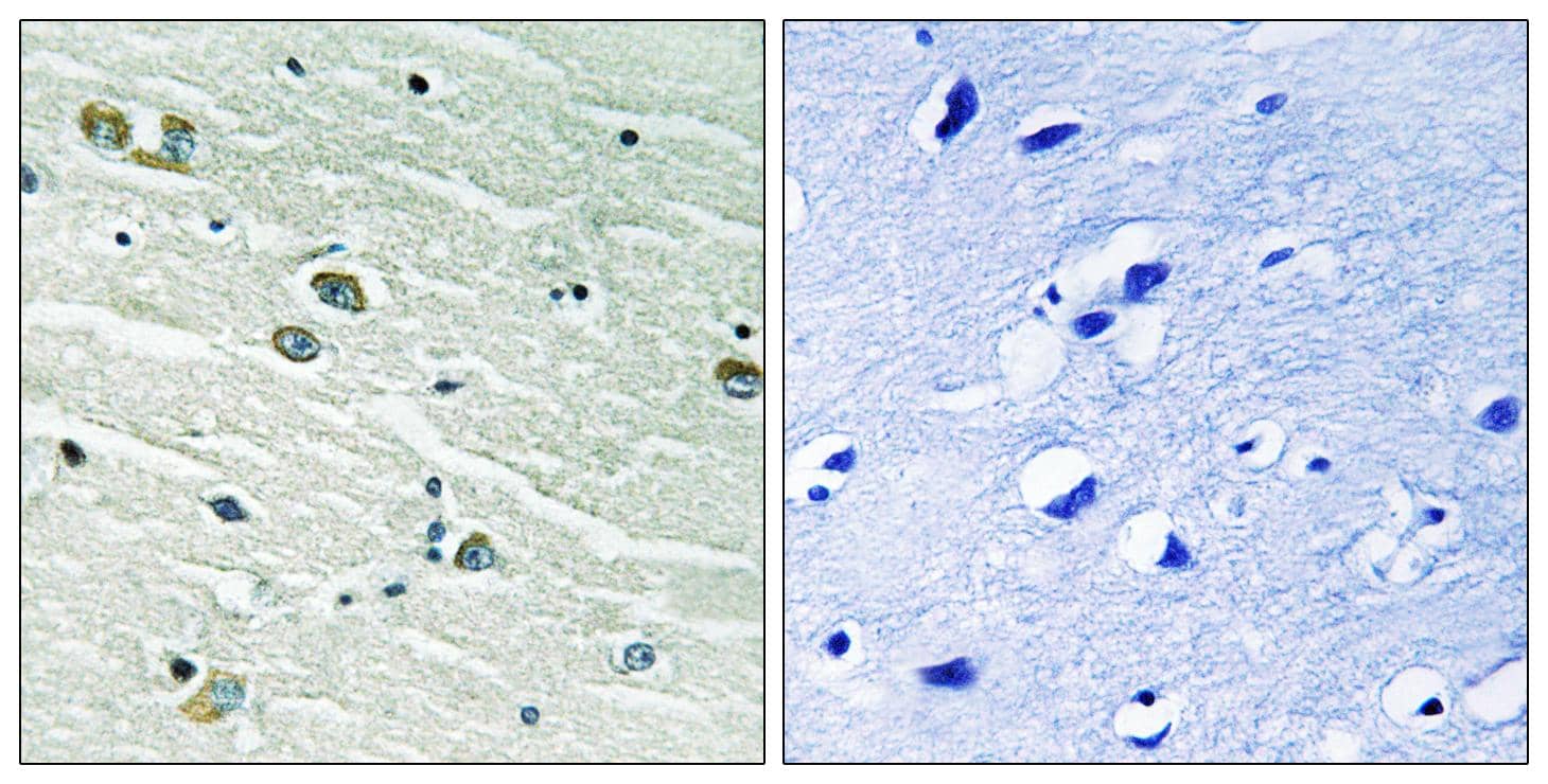 Immunohistochemistry-Paraffin: Tyro3/Mer Antibody [NBP3-27686] - Immunohistochemistry analysis of paraffin-embedded human brain tissue. The picture on the right is blocked with the synthesized peptide.