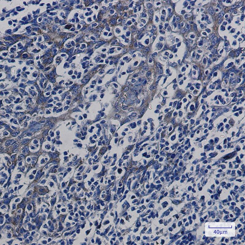 Immunohistochemistry-Paraffin ATP synthase C mature Antibody (SR2374)