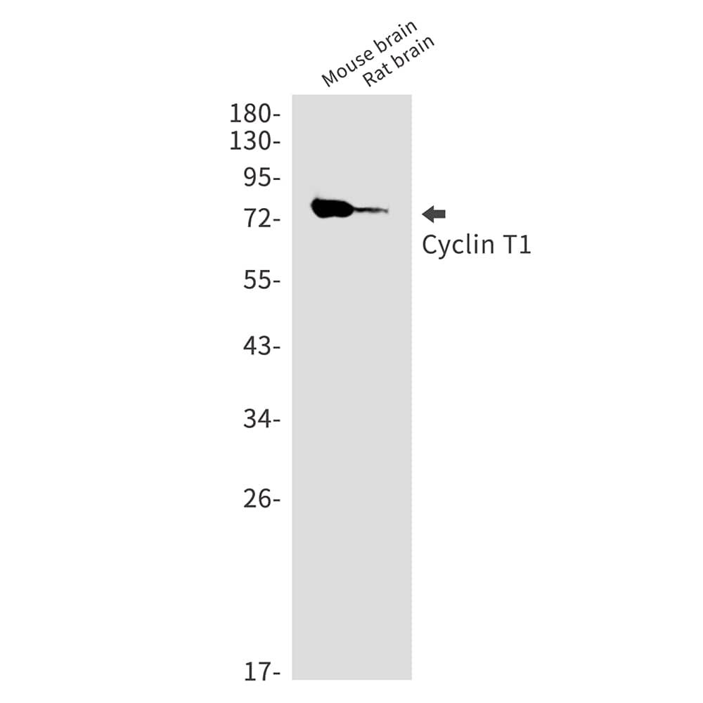 Western Blot: Cyclin T1 Antibody (SR2399) [NBP3-27694] - Western blot analysis of Cyclin T1 in mouse brain, rat brain lysates