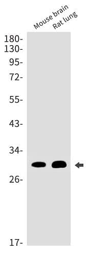 Western Blot: DNAJC8 Antibody (SR2404) [NBP3-27696] - Western blot analysis of mouse brain, rat lung lysates