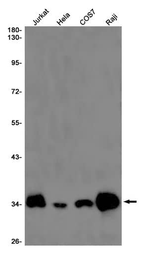 Western Blot: DNAJC8 Antibody (SR2404) [NBP3-27696] - Western blot analysis of Jurkat, Hela, COS7, Raji lysates