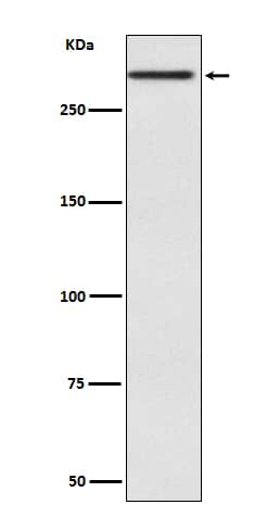 Western Blot: Cubilin Antibody (SR2571) [NBP3-27698] - Western blot analysis of Cubilin expression in Human fetal kidney lysate.