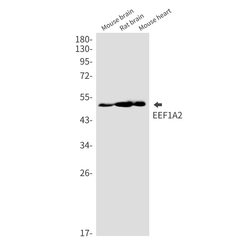 Western Blot: EEF1A2 Antibody (SR2523) [NBP3-27702] - Western blot analysis of EEF1A2 in mouse brain, rat brain, mouse heart lysates