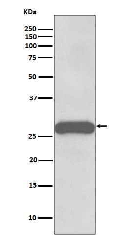 Western Blot: Protein Phosphatase inhibitor 1 Antibody (SR3103) [NBP3-27703] - Western blot analysis of Rat brain lysate.