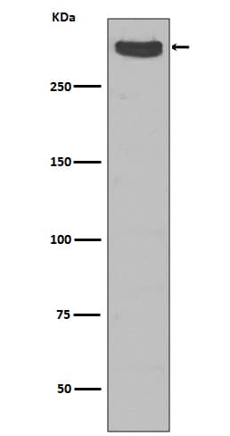 Western Blot: Cubilin Antibody (SR2585) [NBP3-27704] - Western blot analysis of Cubilin expression in Human fetal kidney lysate.