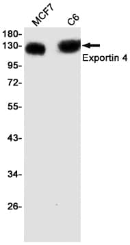 Western Blot Exportin 4 Antibody (SR2408)