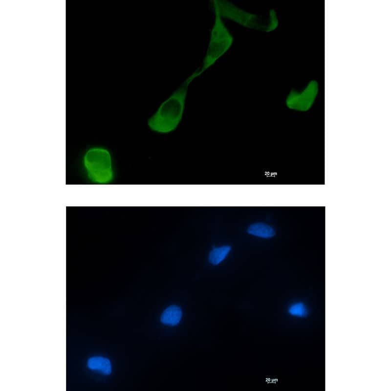 Immunocytochemistry/ Immunofluorescence GFPT2 Antibody (SR2416)