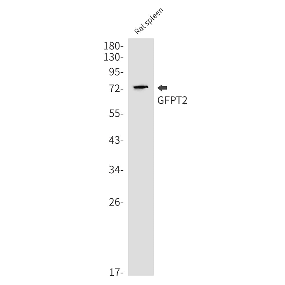 Western Blot GFPT2 Antibody (SR2416)