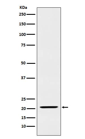 Western Blot: IL-23 Antibody (SR1328) [NBP3-27718] - Western blot analysis of IL-23 expression in Raji cell lysate.