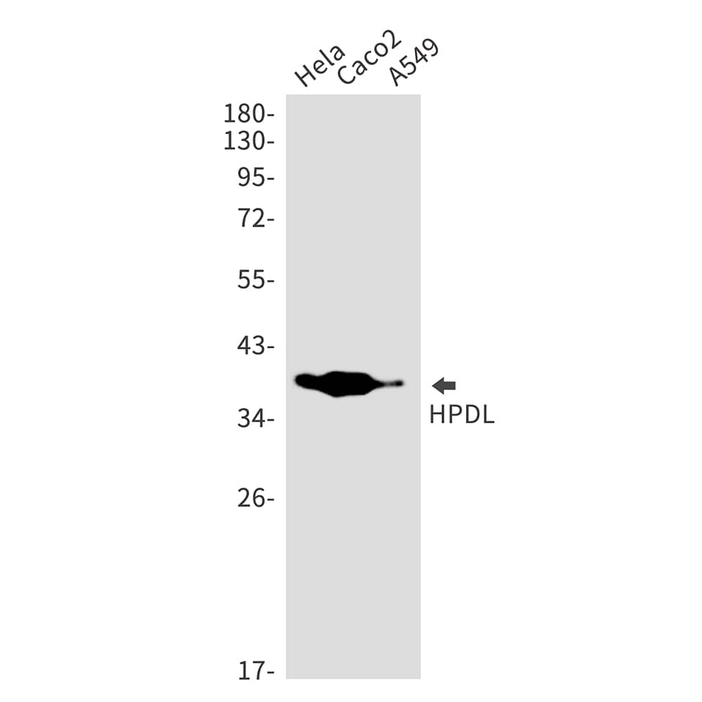 Western Blot: HPDL Antibody (SR2424) [NBP3-27725] - Western blot analysis of HPDL in Hela, Caco2, A549 lysates