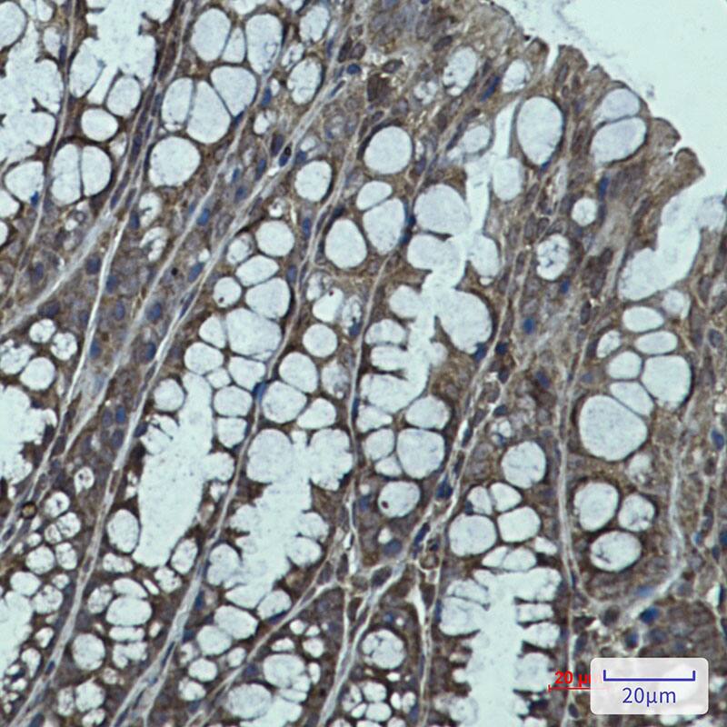 Immunohistochemistry-Paraffin: IGF2BP1 Antibody (SR2428) [NBP3-27730] - Immunohistochemistry analysis of paraffin-embedded mouse colon. High-pressure and temperature Sodium Citrate pH 6.0 was used for antigen retrieval.