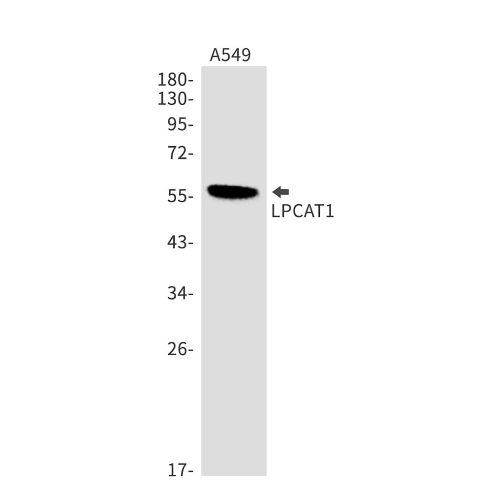 Western Blot: LPCAT1 Antibody (SR2433) [NBP3-27731] - Western blot analysis of LPCAT1 in A549 lysates