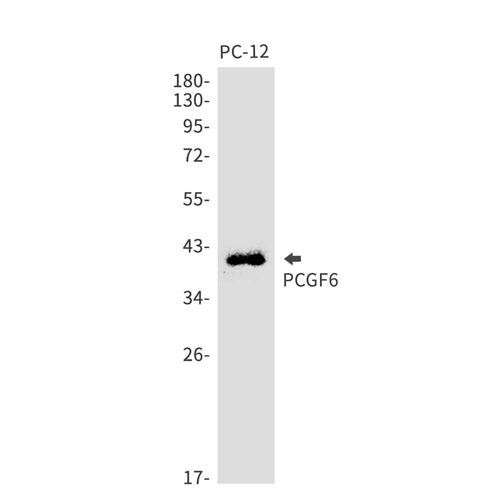 Western Blot: PCGF6 Antibody (SR2460) [NBP3-27743] - Western blot analysis of PC-12 lysates