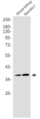 Western Blot: PP1 alpha/beta catalytic subunit Antibody (SR2468) [NBP3-27747] - Western blot analysis of mouse kidney, Raw264.7 lysates