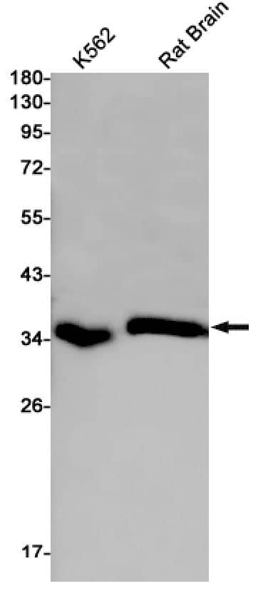 Western Blot: PP1 alpha/beta catalytic subunit Antibody (SR2468) [NBP3-27747] - Western blot analysis of K562, rat Brain lysates