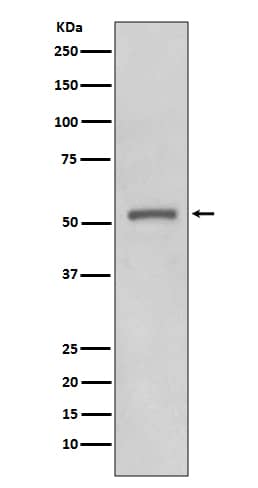 Western Blot: MMP-11 Antibody (SR3093) [NBP3-27748] - Western blot analysis of MMP-11 expression in MCF-7 cell lysate.