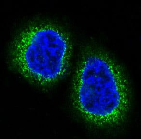 Immunocytochemistry/ Immunofluorescence: HDAC10 Antibody (SR3178) [NBP3-27754] - Immunofluorescent analysis of Hela cells