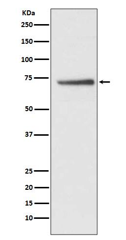 Western Blot: CDC16 Antibody (SR3221) [NBP3-27756] - Western blot analysis of HepG2 cell lysate.