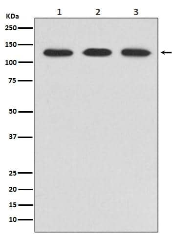 Western Blot: ABL2 Antibody (23B9) [NBP3-27762] - All Lanes: NBP3-27762 at 1:1000 dilution. Lane 1: HeLa cell lysate. Lane 2: NIH/3T3 cell lysate. Lane 3: PC-12 cell lysate. (Proteins at 20ug per lane) Secondary: Goat Anti-Rabbit IgG [HRP] at 1:20000 dilution. Predicted band size: 128 kDa. Observed band size: 128 kDa