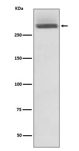 Western Blot: Laminin alpha 3/Laminin-5 Antibody (SR3297) [NBP3-27766] - Western blot analysis of HeLa cell lysate.