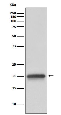 Western Blot: Claudin-5 Antibody (SR3444) [NBP3-27772] - Western blot analysis of Claudin-5 expression in human fetal brain lysate.