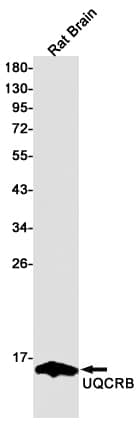 Western Blot: UQCRB Antibody (SR2510) [NBP3-27777] - Western blot analysis of UQCRB in rat Brain lysates