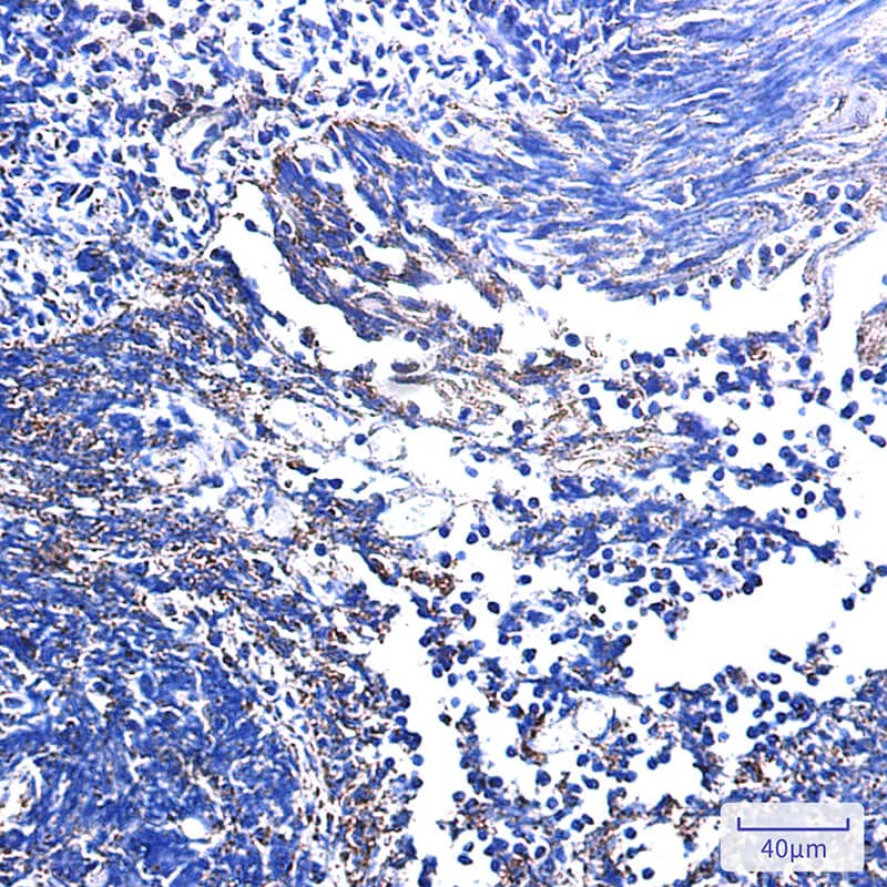 Immunohistochemistry-Paraffin: UQCRB Antibody (SR2510) [NBP3-27777] - Immunohistochemistry analysis of paraffin-embedded Human tonsil. High-pressure and temperature Sodium Citrate pH 6.0 was used for antigen retrieval.