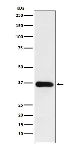 Western Blot: 11 beta-HSD1 Antibody (SR3601) [NBP3-27783] - Western blot analysis of human fetal liver lysate.