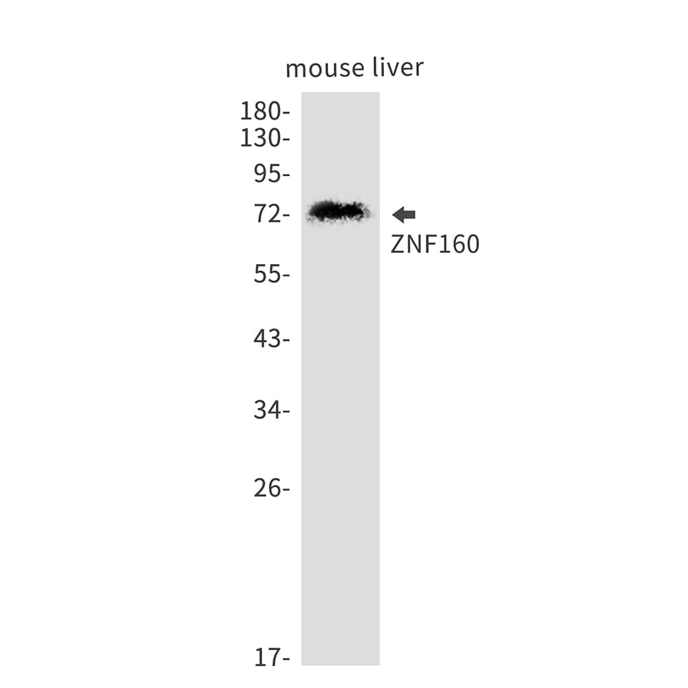 Western Blot: ZNF160 Antibody (SR2512) [NBP3-27785] - Western blot analysis of ZNF160 in mouse liver lysates