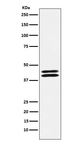 Western Blot: PON2 Antibody (SR3802) [NBP3-27800] - Western blot analysis of PON2 expression in HeLa cell lysate.