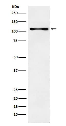 Western Blot: CENPC Antibody (SR3810) [NBP3-27802] - Western blot analysis of CENPC expression in K562 cell lysate.
