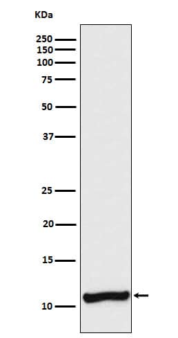 Western Blot: VAMP3/Cellubrevin Antibody (SR3817) [NBP3-27803] - Western blot analysis of A375 cell lysate.