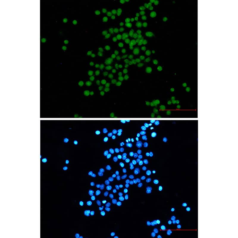 Immunocytochemistry/ Immunofluorescence: SV40 T-antigen Antibody (SR2545) [NBP3-27808] - Immunocytochemistry analysis of SV40 T-antigen (green) in HeLa using NBP3-27808, and DAPI (blue)