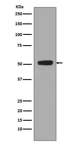Western Blot: p53 [p Ser 376] Antibody (SR1943) [NBP3-27814] - Western blot analysis of HEK293 cell lysates treated with Calyculin A and Okadaic Acid.