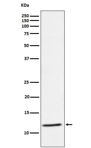 Western Blot: DAP12 Antibody (SR3887) [NBP3-27816] - Western blot analysis of DAP12 expression in Human PBMC cell lysate.