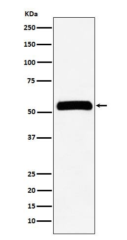 Western Blot: IMP Dehydrogenase 2/IMPDH2 Antibody (SR3949) [NBP3-27817] - Western blot analysis of HeLa cell lysate.