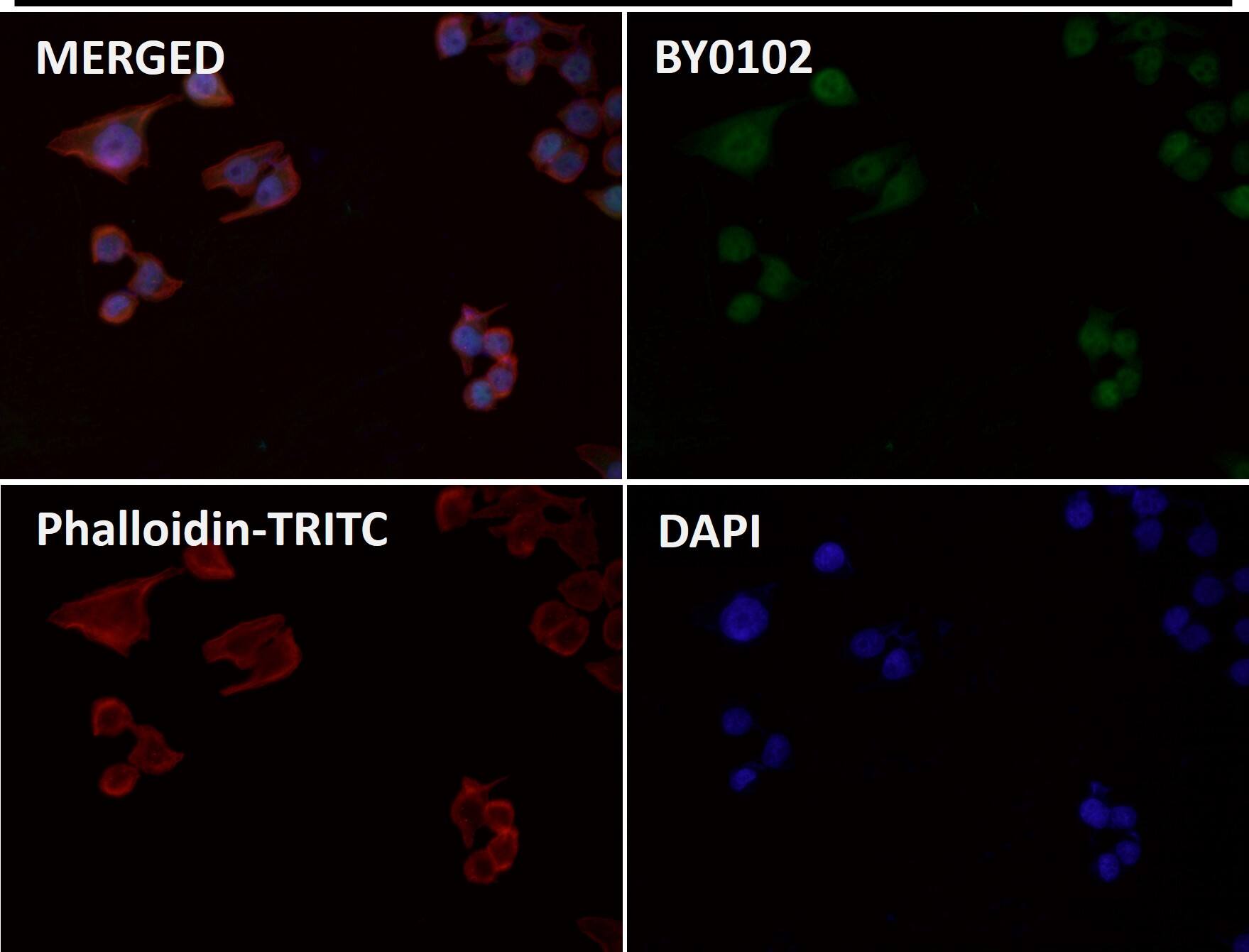 Immunocytochemistry/ Immunofluorescence: CCDC109A [p Ser92] Antibody (SR2322) - BSA Free [NBP3-27827] - Immunofluorescent analysis using NBP3-27827. 