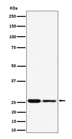 Western Blot: PMF1 Antibody (SR4288) [NBP3-27835] - Western blot analysis of PMF1 expression in (1) HeLa cell lysate; (2) RAW 264.7 cell lysate.