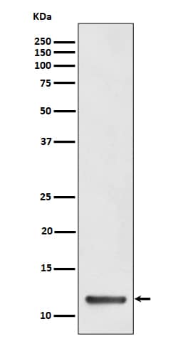 Western Blot: DYNLT1 Antibody (SR4309) [NBP3-27843] - Western blot analysis of HeLa cell lysate.