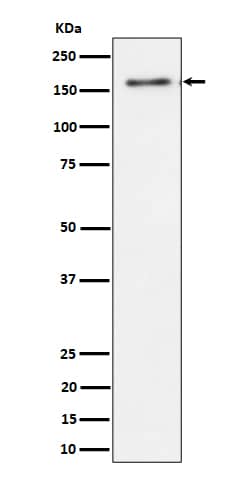 Western Blot TATA Element Modulatory Factor 1 Antibody (SR4313)