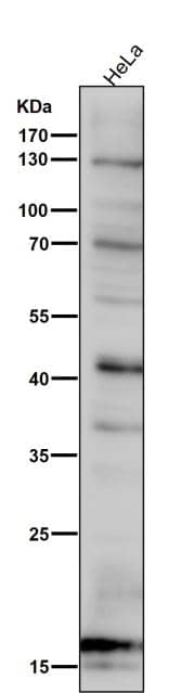 Western Blot: SDHC Antibody (SR4339) [NBP3-27851] - All lanes use the antibody at 1:6000 dilution for 1 hour at room temperature.