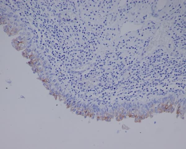 Immunohistochemistry-Paraffin: Uroplakin III Antibody (SR2331) [NBP3-27853] - Immunohistochemical analysis of paraffin-embedded human bladder