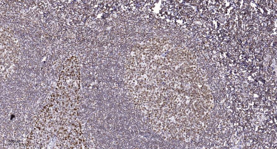 Immunohistochemistry-Paraffin: ALKBH5 Antibody [NBP3-27856] - Immunohistochemical analysis of paraffin-embedded human tonsil.