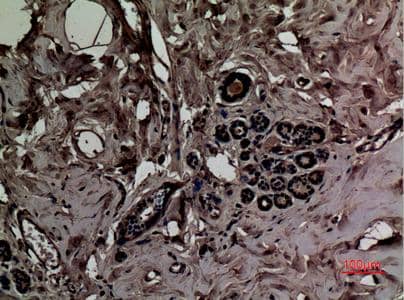 Immunohistochemistry-Paraffin: SLC6A14 Antibody [NBP3-27859] - Immunohistochemical analysis of paraffin-embedded human-breast, antibody was diluted at 1:100